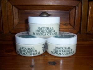 natural psoriasis cream